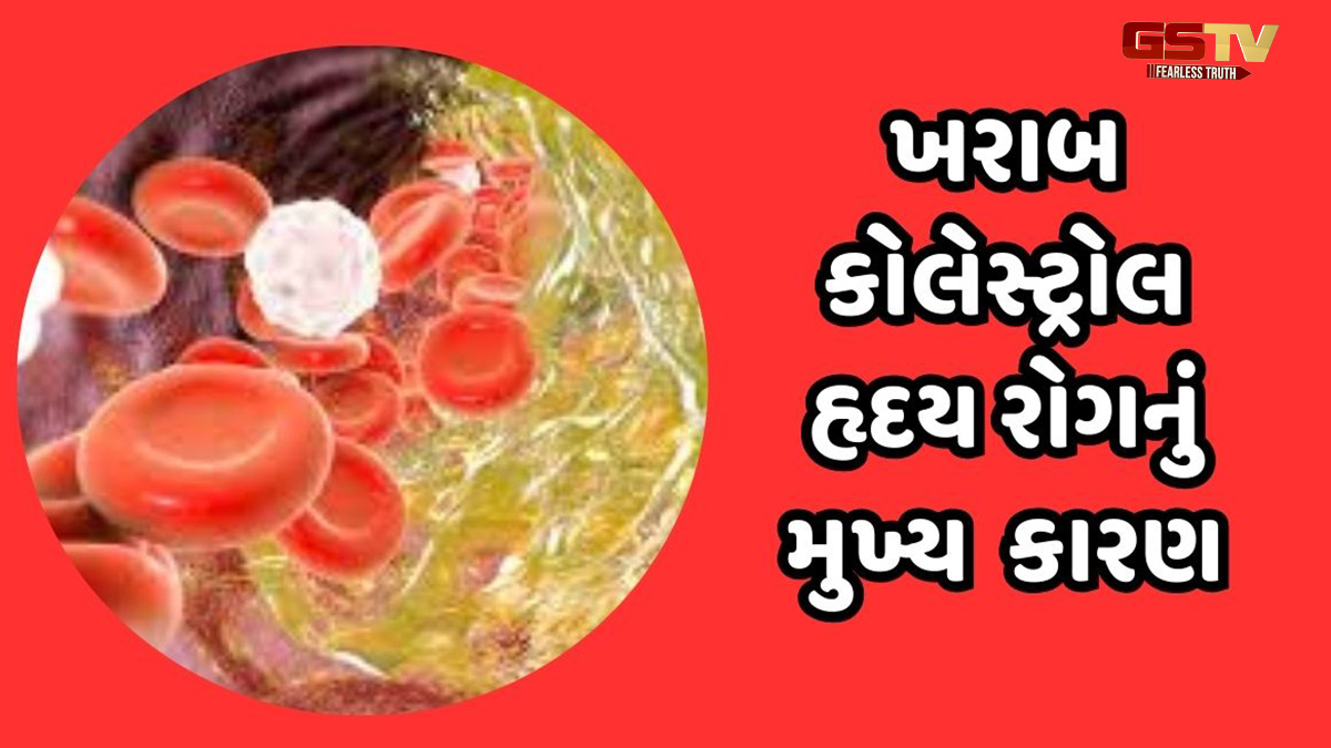 ખરાબ કોલેસ્ટ્રોલને દૂર કરશે આ શાકભાજી, જાણો તેનો કેવી રીતે ઉપયોગ કરવો