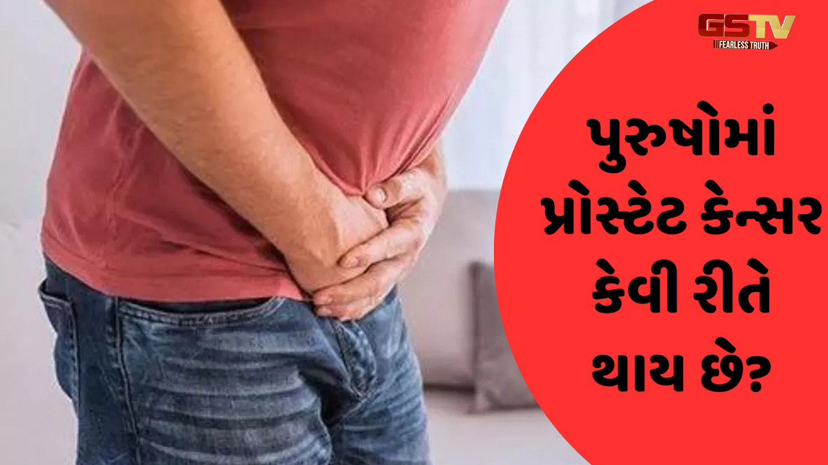 પુરુષોમાં પ્રોસ્ટેટ કેન્સર કેવી રીતે થાય છે? જાણો ક્યારે કરાવવું જોઇએ પરીક્ષણ 