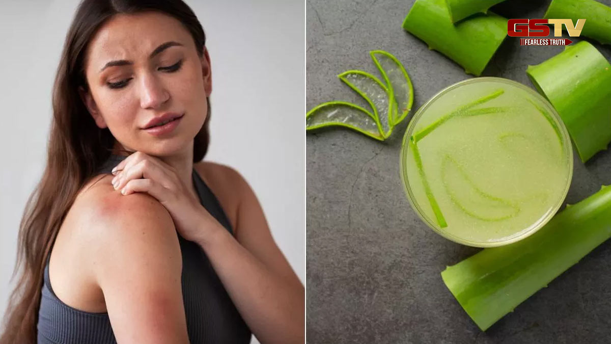 Beauty Tips / આ લોકોએ ભૂલથી પણ ન કરવો જોઈએ એલોવેરાનો ઉપયોગ, થઈ શકે છે ત્વચાની સમસ્યાઓ