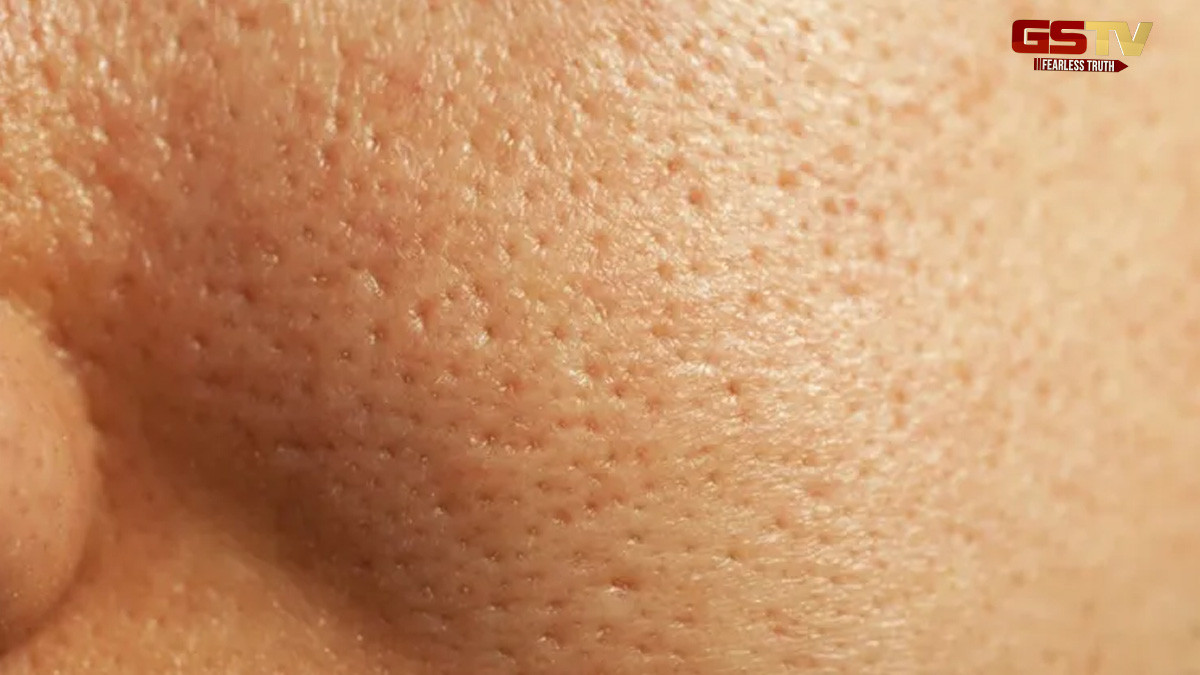 Beauty Tips : ખુલ્લા છિદ્રોથી છુટકારો મેળવવા માટે ઘરે જ બનાવો આ ફેસ પેક