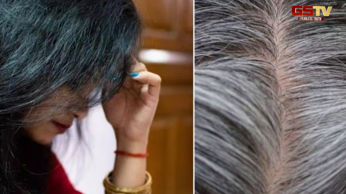 Hair Care Tips: વાળ ઝડપથી સફેદ થઈ રહ્યા છે, તો આ બાબતોનું રાખો ધ્યાન