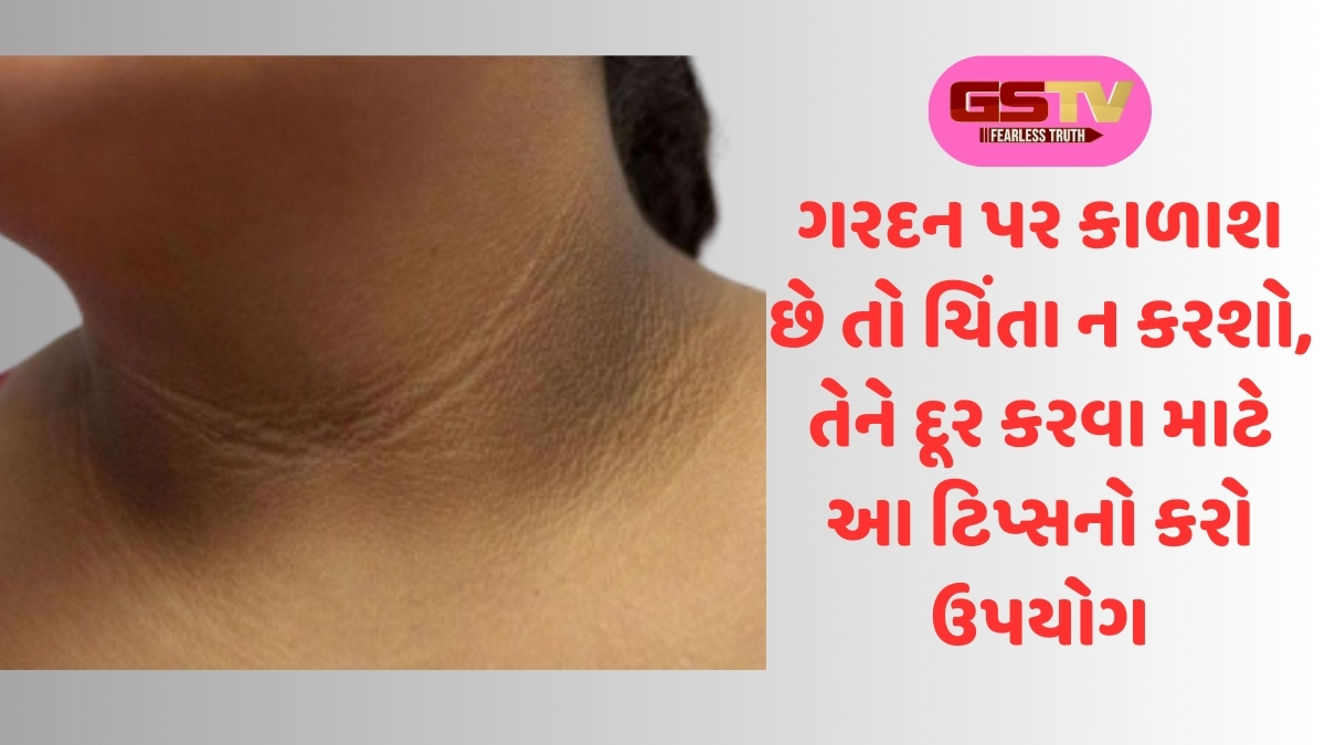 Dark Neck Remedies: ગરદન પર કાળાશ છે તો ચિંતા ન કરશો, તેને દૂર કરવા માટે આ ટિપ્સનો કરો ઉપયોગ