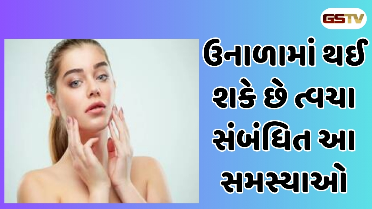 Skin Care Tips : ઉનાળામાં થઈ શકે છે ત્વચા સંબંધિત આ સમસ્યાઓ, જાણો કેવી રીતે કાળજી લેવી