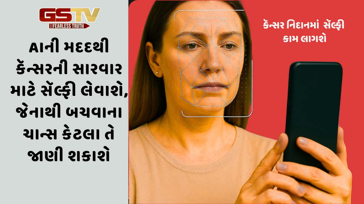 Health: કૅન્સરની સારવાર માટે AIની નવી ટેક્નોલૉજી, સૅલ્ફીથી કૅન્સર શોધવા અને બચવા આવી રીતે ઉપયોગમાં લેવાશે