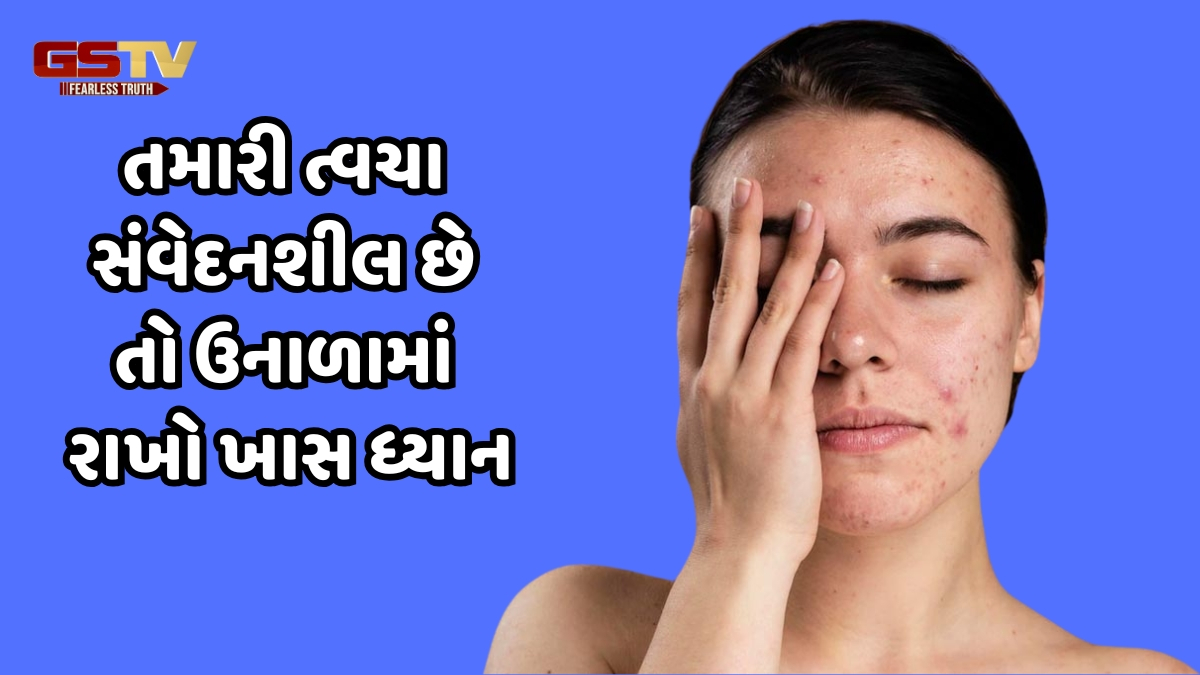 Skin Care Tips / ઉનાળામાં આવી રીતે રાખો સંવેદનશીલ ત્વચાનું ધ્યાન, નહીં તો કરવો પડશે મુશ્કેલીઓનો સામનો
