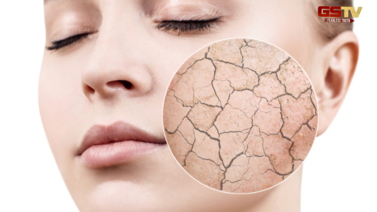 Skin Care Tips : ડ્રાય સ્કિન માટે આ 6 વસ્તુઓ વરદાનથી ઓછી નથી, ચહેરો રહેશે માખણ જેવો નરમ 