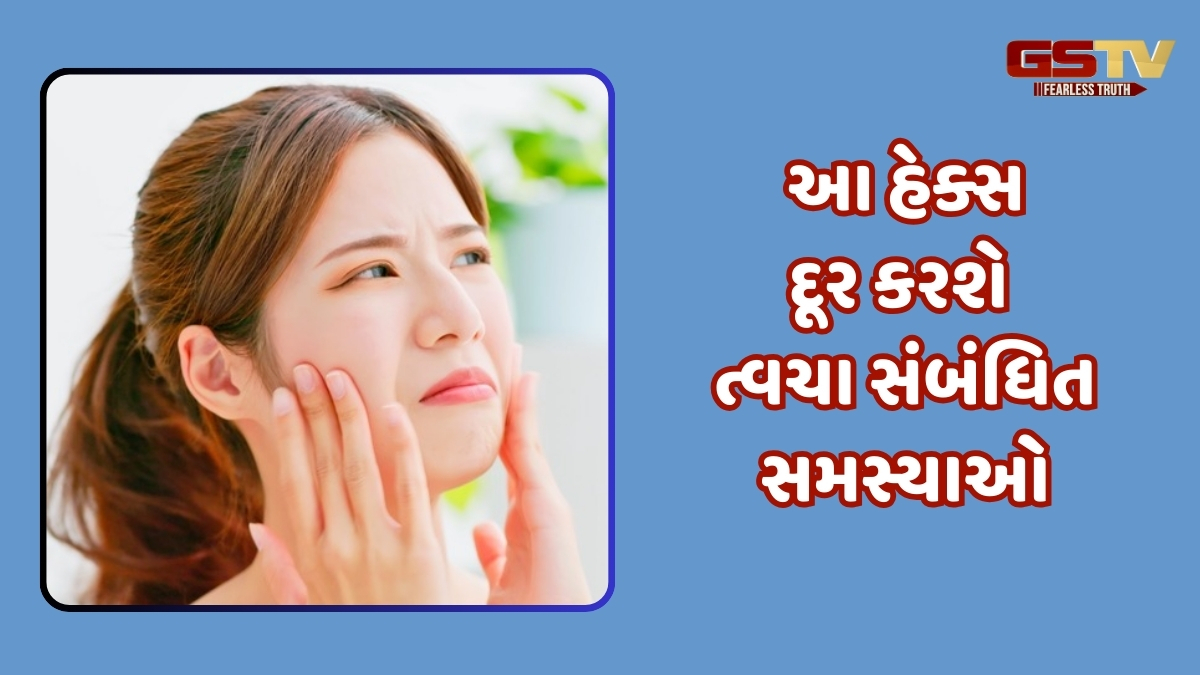 Beauty Tips / વધતા તાપમાનને કારણે ચીકણી થઈ જાય છે ત્વચા? તો અજમાવો આ સરળ ઉપાયો