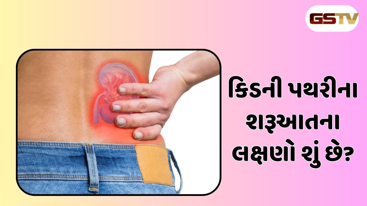 Health Tips : ઉનાળામાં કિડનીમાં પથરીની સમસ્યા કેમ વધે છે, જાણો કેવી રીતે કાળજી લેવી