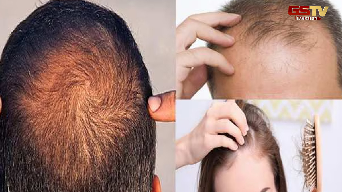 Hair Care Tips : શું તમે ઉનાળામાં વાળ ખરવાથી ચિંતિત છો? તો આ સરળ ટિપ્સ કરો ફોલો