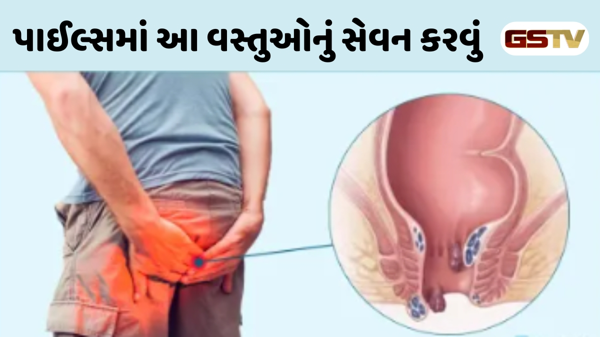 Health Tips : હરસ મસાના દર્દીઓએ ક્યારેય આ 5 વસ્તુઓ ન ખાવી જોઈએ, નહીં તો મુશ્કેલી વધી જશે અનેક ગણી 