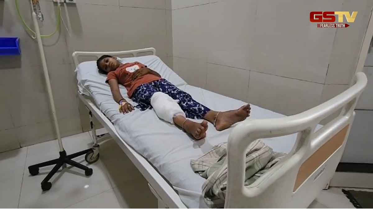 Chhotaudepur News: બોડેલીના અલીપુરામાં કપિરાજનો આતંક યથાવત, બાળકી પર હુમલો થતા ગંભીર