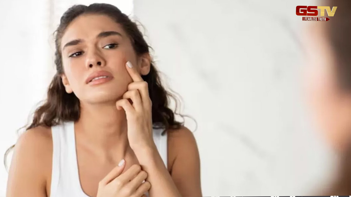 Skin Care: સ્કિન કેર છતાં ચહેરો ડલ દેખાય છે? જાણો શું છે કારણો