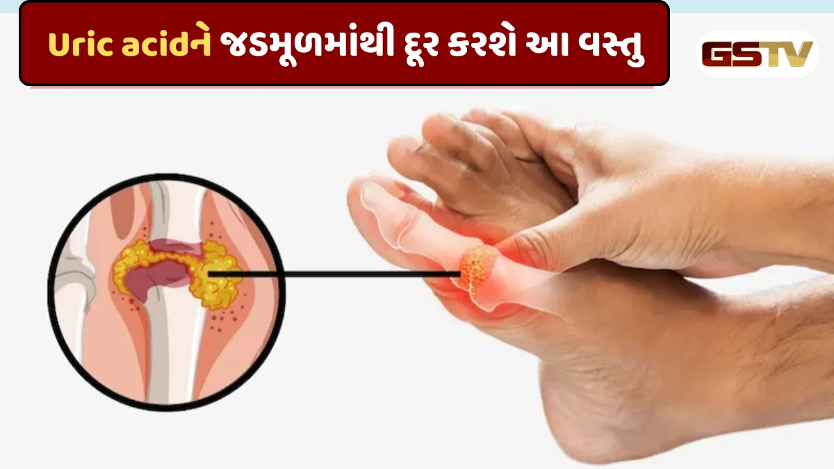 Health Tips : યુરિક એસિડ ઝડપથી ઘટાડશે આ વસ્તુ, સાંધાનો દુખાવો અને કિડનીમાંથી પથરી કરશે દૂર 