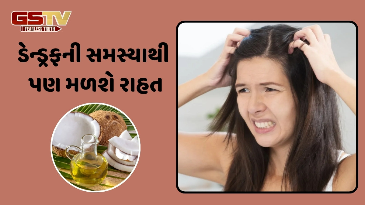 Hair Care Tips / પરસેવાના કારણે સ્કેલ્પમાં ખંજવાળ આવે છે? તો નાળિયેર તેલમાં 2 વસ્તુ મિક્સ કરીને લગાવો