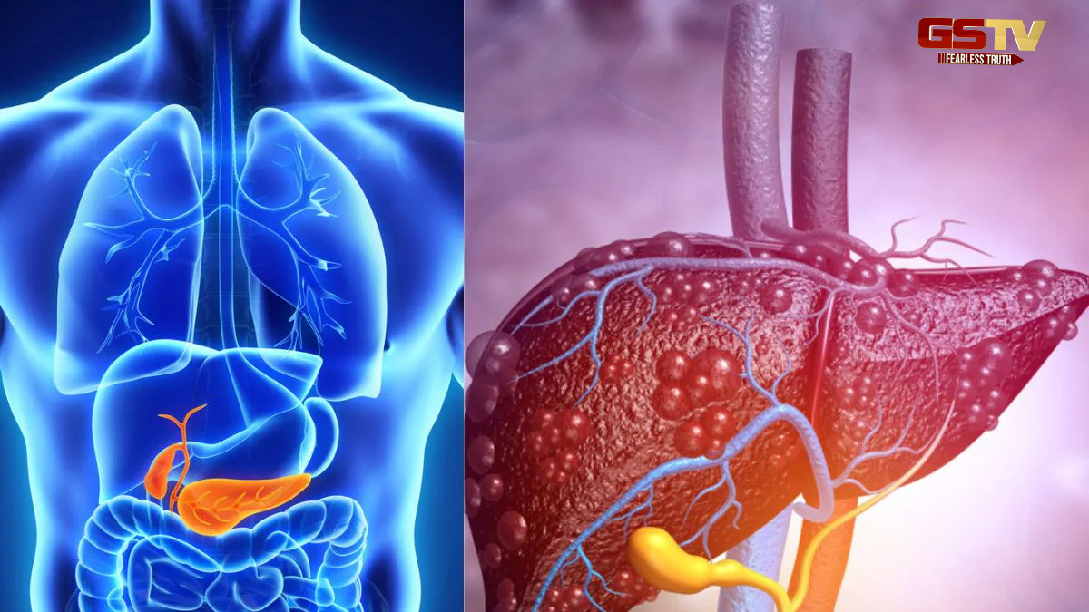 Health Tips  : લીવરમાં જમા થયેલી ચરબી જડમૂળમાંથી થશે છુમંતર, આ ઘરેલુ નુસ્ખા કરો ફોલો