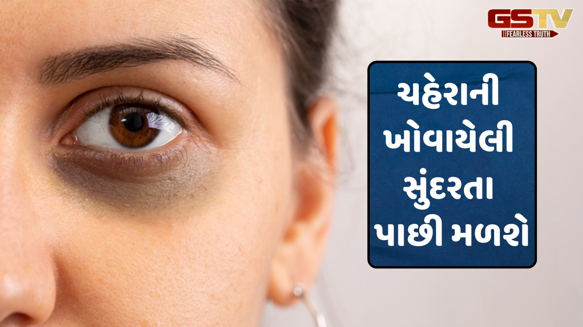 Beauty Tips / એક અઠવાડિયામાં ઓછા થઈ શકે છે ડાર્ક સર્કલ્સ, ટ્રાય કરો આ સરળ ઘરેલું ઉપાયો
