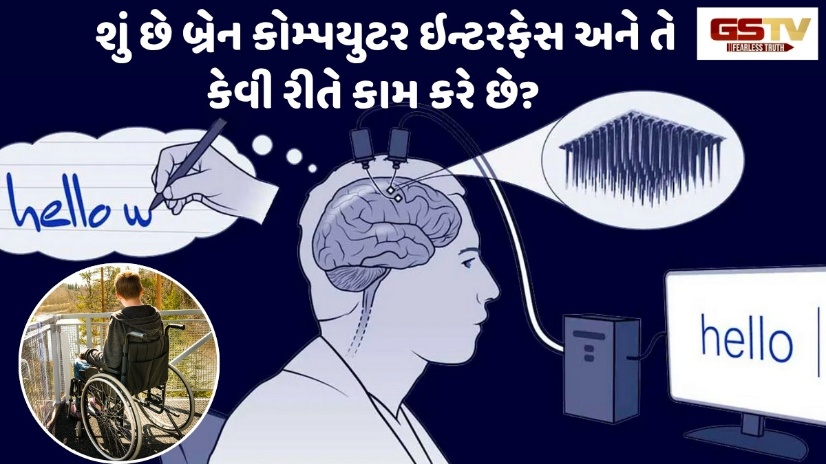 Business:  AIની મદદથી લકવાગ્રસ્ત દર્દી શું બોલવા માંગે છે તે જાણી શકાશે 