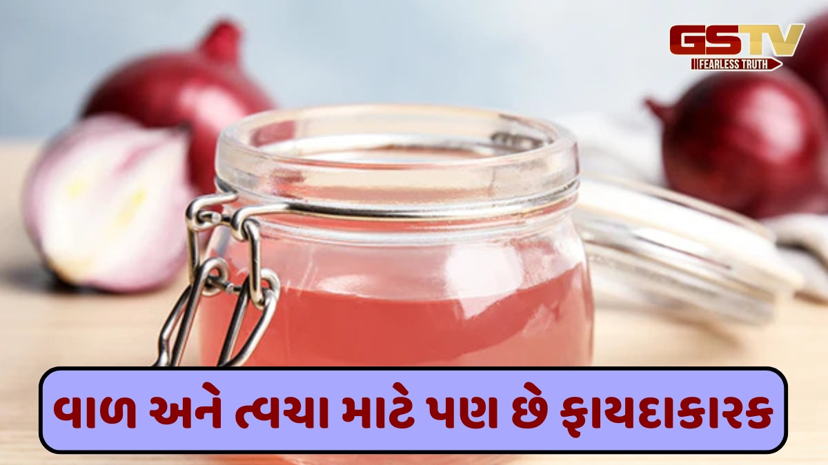 Health: સ્વાસ્થ્યનો ખજાનો હોય છે ડુંગળીનો રસ, આ 5 સમસ્યાઓ માટે રામબાણ ઈલાજ!