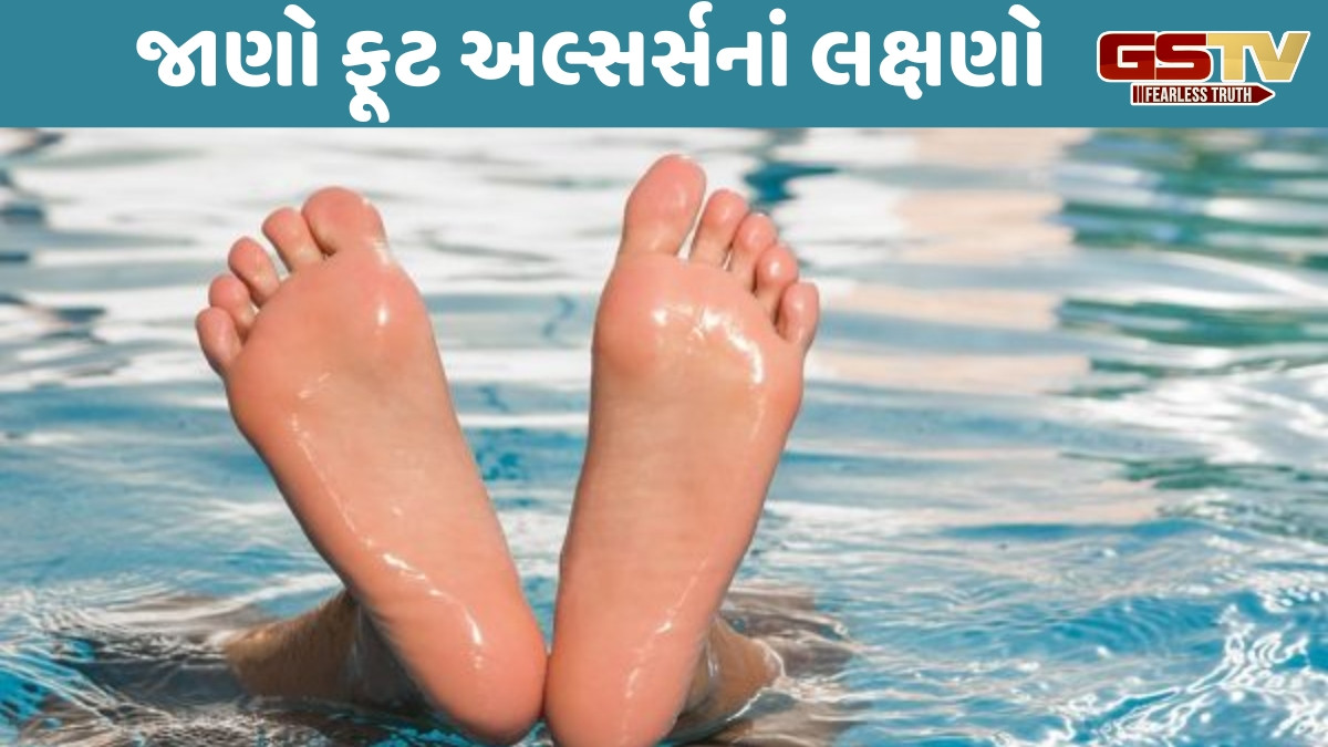Health: ફૂટ અલ્સર્સ એટલે શું? તેનું નિદાન કઇ કઇ પદ્ધતિથી થાય છે?