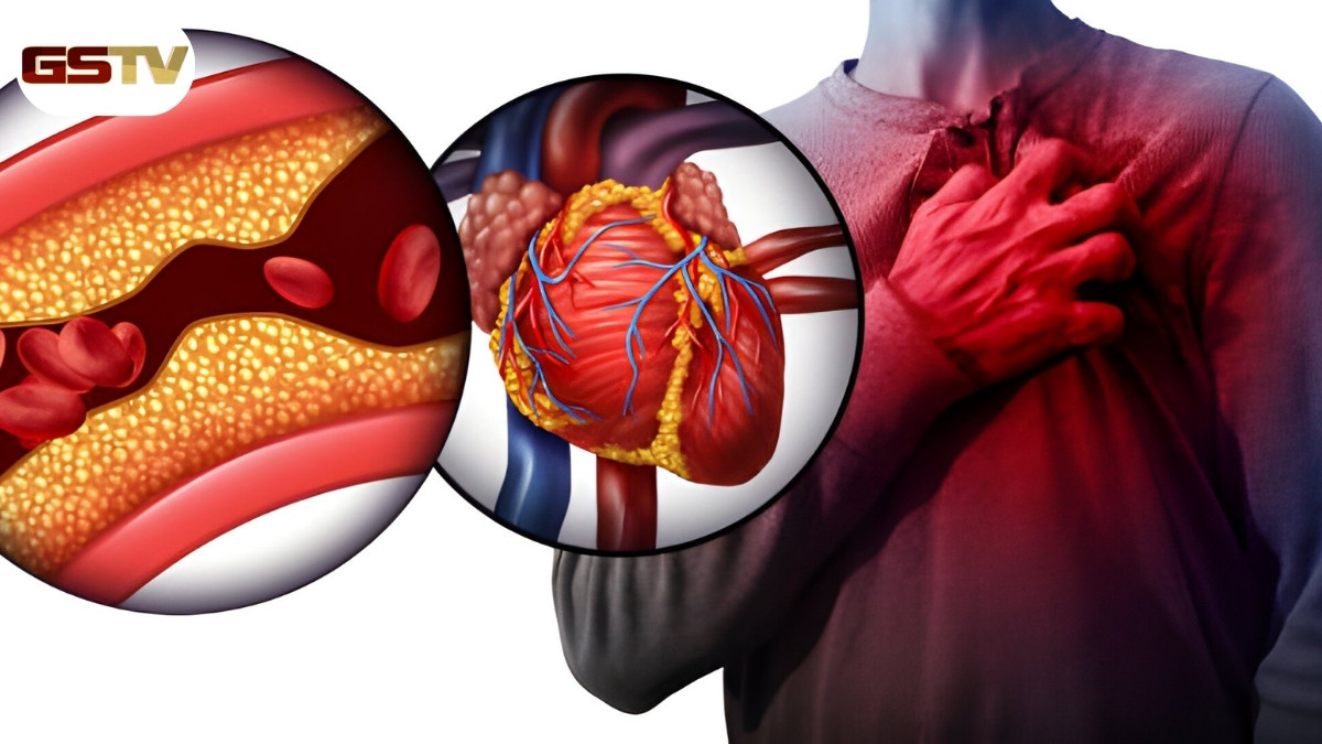 Heart Blockage: આ 5 લક્ષણોથી જાણો તમારું હૃદય યોગ્ય રીતે કામ કરી રહ્યું છે કે નહીં, બ્લોકેજ પહેલા આ બાબતો જાણવી જરૂરી