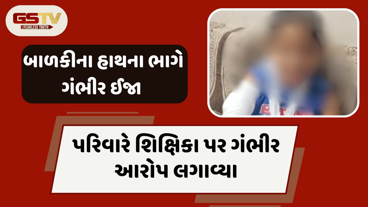 Panchmahal news: 5 વર્ષીય બાળકીને શિક્ષિકાએ લાકડી વડે ફટકા માર્યાનો આરોપ, માસૂમને પહોંચી ગંભીર ઈજા