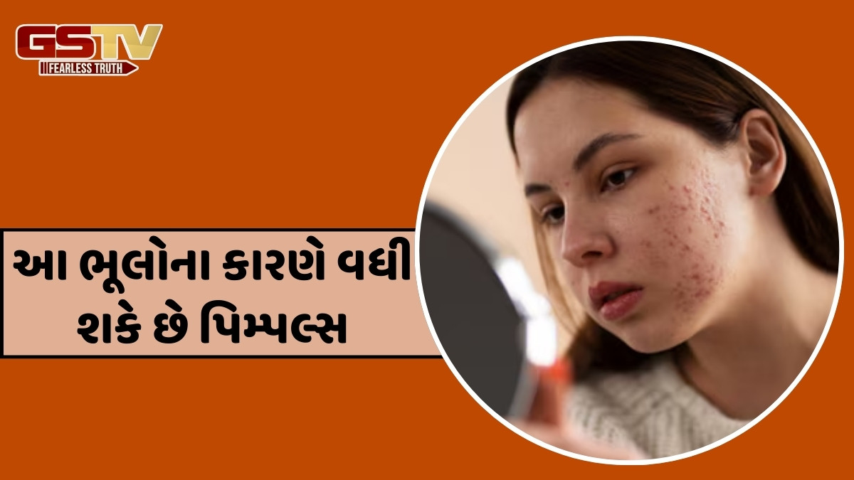 Skin Care / પિમ્પલ્સથી છુટકારો મેળવવાના પ્રયાસમાં તમે પણ કરી રહ્યા છો આ 3 ભૂલો? સમસ્યા ઘટવાને બદલે વધી જશે