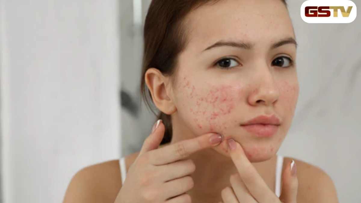 Skin Care: જો તમારી ત્વચા સંવેદનશીલ હોય તો આયુર્વેદ મુજબ આ રીતે લો કાળજી