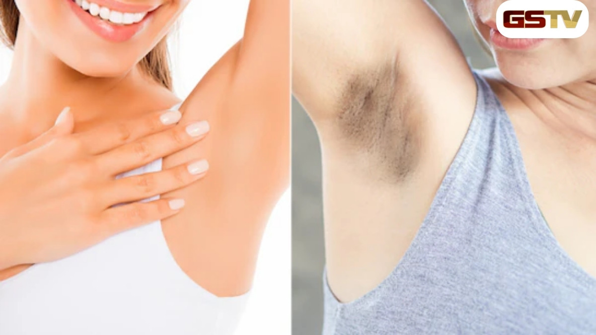 Beauty Tips: અંડરઆર્મ્સની કાળાશથી શરમજનક અનુભવ કરો, તો આ 5 ઘરેલું ઉપાયોથી ઝડપથી મેળવો છુટકારો