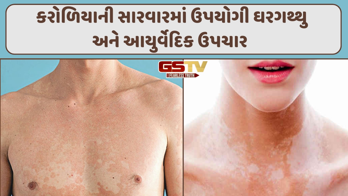 Sahiyar: કરોળિયાની સારવાર અને બાળ ઉપયોગી પ્રયોગો