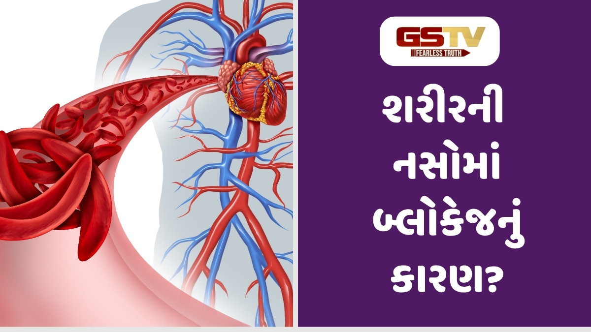 Health Tips : યુવાનીમાં જ શરીરની નસો બ્લોક થઈ છે? આ ગંભીર સમસ્યાથી છુટકારા માટે 2 વસ્તુઓનું કરો સેવન 