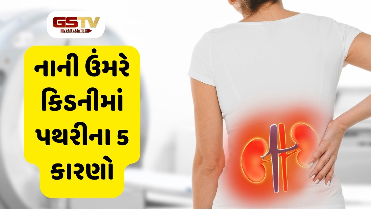 Health Tips : 20-25 વર્ષના યુવાનોમાં કિડનીની બીમારી કેમ વધી રહી? આના માટે 5 કારણો જવાબદાર