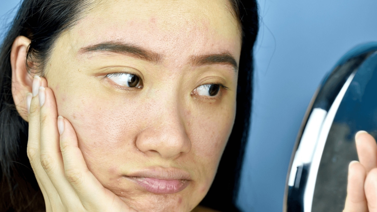 Skin Care Tips : ડલ સ્કિન પણ ચમકવા લાગશે, સવારે ખાલી પેટે પીવો આ પાણી