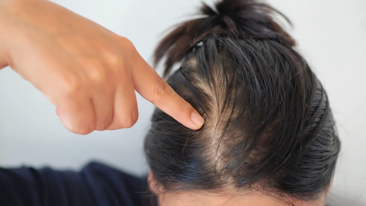 Hair Care : વાળની સમસ્યા હોય તો આ 5 ઘરેલું ઉપાયો અપનાવો, થોડા દિવસોમાં જ દેખાશે અસર!