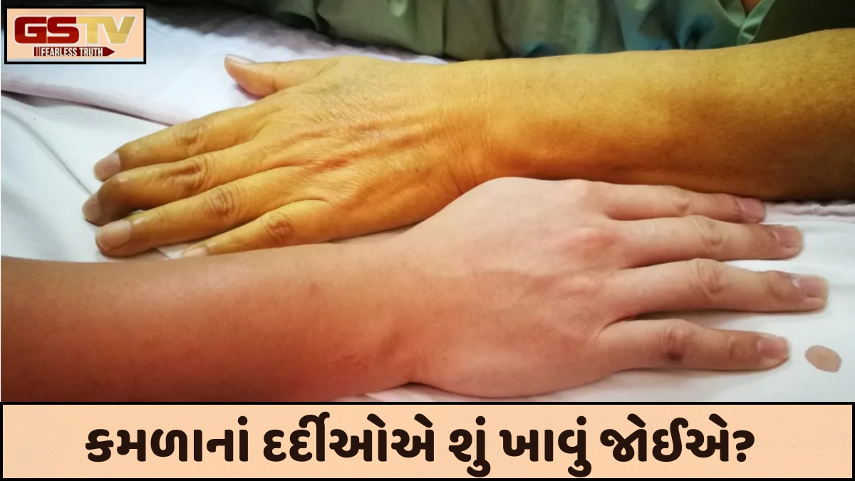 Sahiyar: કમળામા અક્સીર નિવડશે આ આયુર્વેદિક ઉપચારો