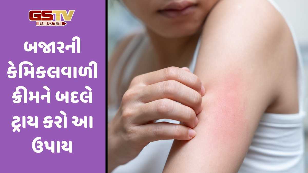 Skin Care Tips / શું ભેજને કારણે ત્વચા પર થઈ રહ્યા છે રેસિસ? તો ઘરમાં રહેલી આ વસ્તુઓ આપશે તાત્કાલિક રાહત