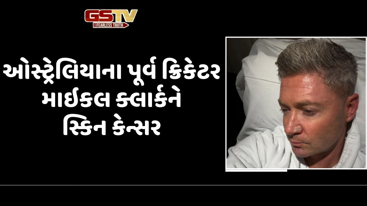 ઓસ્ટ્રેલિયન દિગ્ગજ માઇકલ ક્લાર્કને થયું સ્કિન કેન્સર, લોકોને કરી ખાસ અપીલ