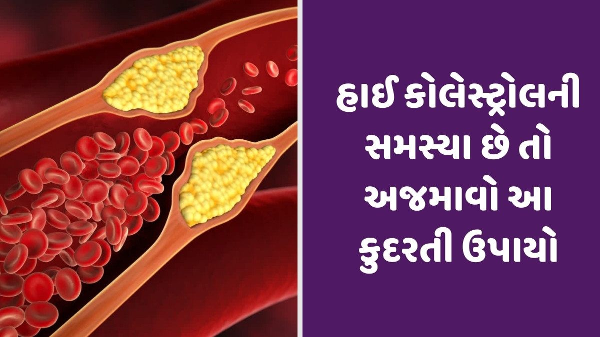 Health Tips : હાઈ કોલેસ્ટ્રોલની સમસ્યા છે તો અજમાવો આ કુદરતી ઉપાયો, દવા વગર જ રહેશે કંટ્રોલ