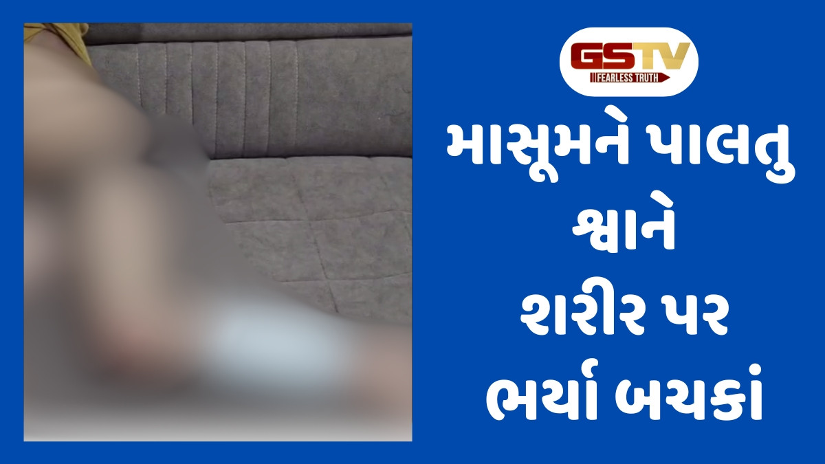 Surat news: પર્વત પાટિયા વિસ્તારમાં પાલતુ શ્વાને માસૂમ પર કર્યો હુમલો, પીડિત પરિવારને શ્વાન માલિકે આપી ધમકીઓ