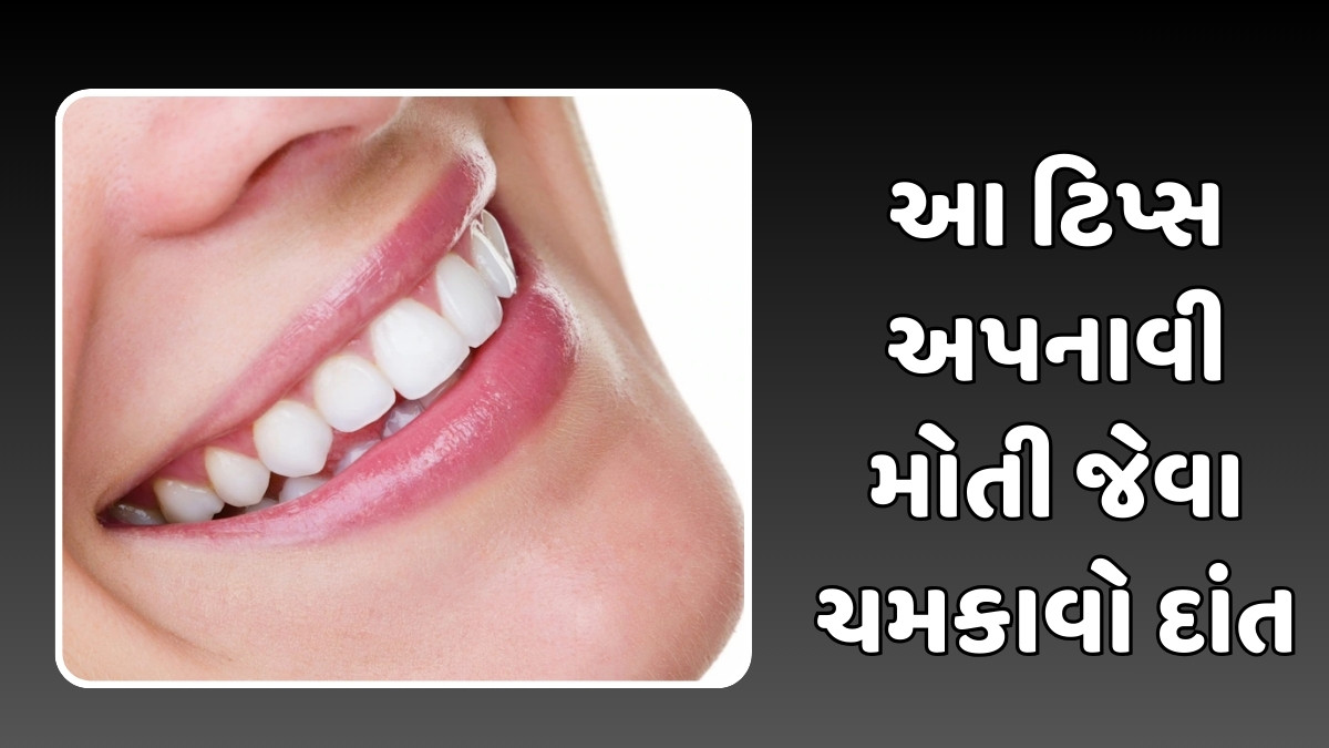 Beauty Tips : ગમે તેવા પીળા દાંત હશે તો પણ સફેદ થઈ જશે, આ ટિપ્સ અપનાવી મોતી જેવા ચમકાવો દાંત