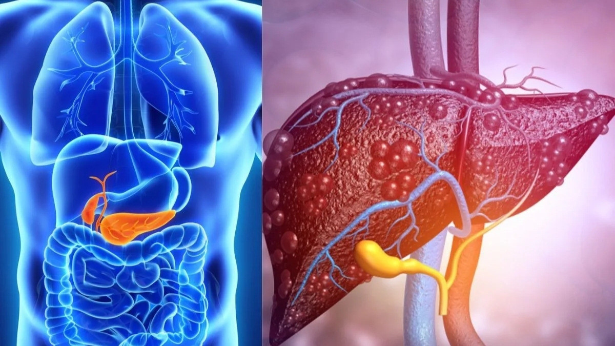 Health Tips : આ પીણું દૂર કરશે લીવરમાં જમા થયેલી ચરબી, નિરોગી રહેવા જરૂર કરો સેવન