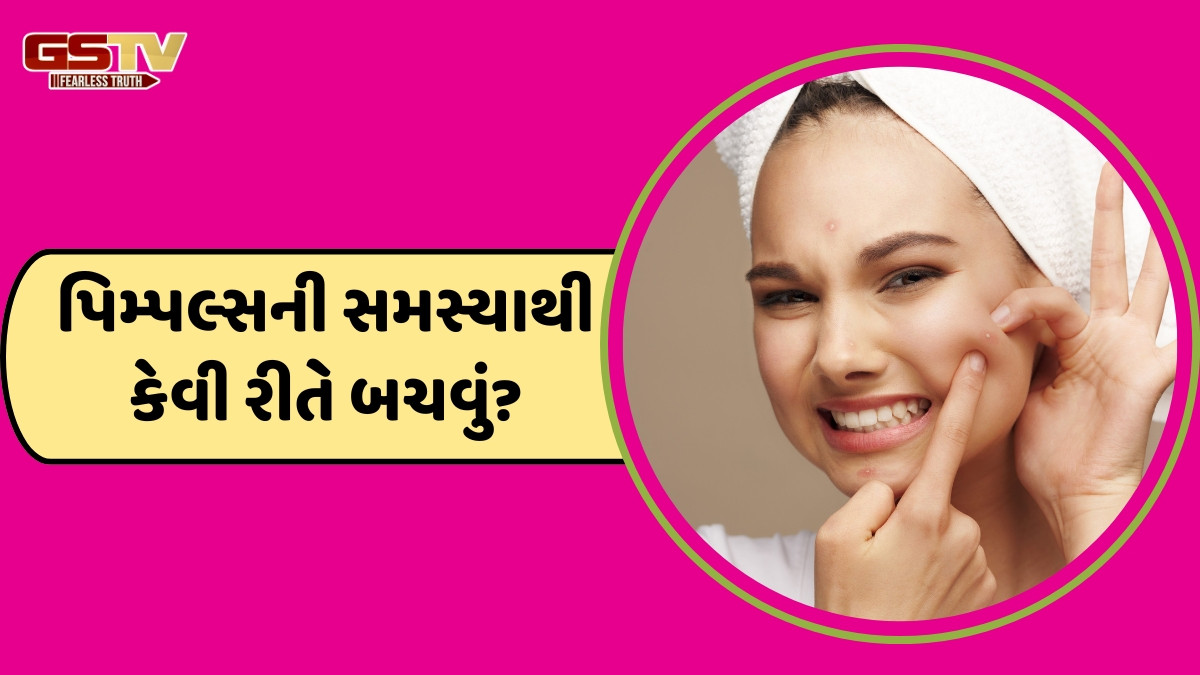Skin Care Tips / આ 5 ભૂલોને કારણે વારંવાર પાછા આવે છે પિમ્પલ્સ, તેને નહીં સુધારો તો થશે નુકસાન