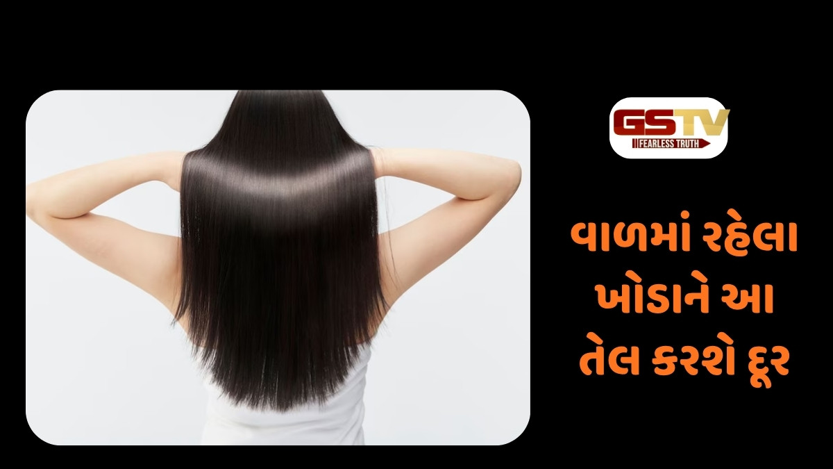 Hair Care : વાળમાં રહેલા ખોડાને આ તેલ કરશે દૂર, ઝડપથી વધશે હેર ગ્રોથ