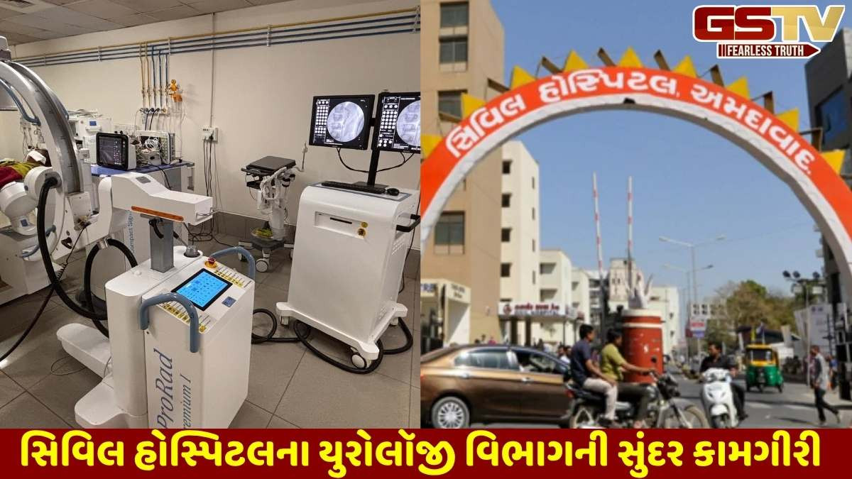 Ahmedabad news: સિવિલ હોસ્પિટલમાં 11 માસમાં 700 દર્દીઓને કિડનીમાં પથરીના ઓપરેશન વગર સાજા કર્યા