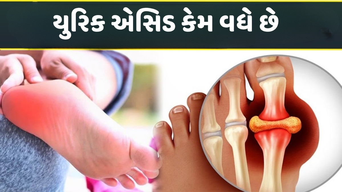 Health Tips : યુરિક એસિડ વધી જવાથી આ ગંભીર બીમારીઓનો રહે છે ખતરો