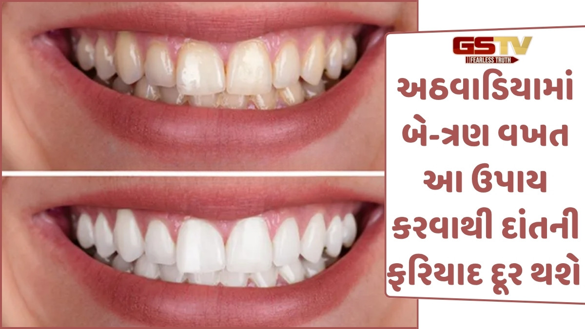 Sahiyar: દાંત પરના કાળા-પીળા ડાઘ તથા અન્ય સમસ્યાઓ દૂર કરવામાં ઉપયોગી નિવડશે આ સરળ ઉપાયો