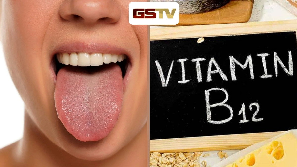 Health Tips : જીભમાં દેખાય આ લક્ષણો તો હોઈ શકે છે વિટામિન B12ની ઉણપ, આજે જ કરો ચેક