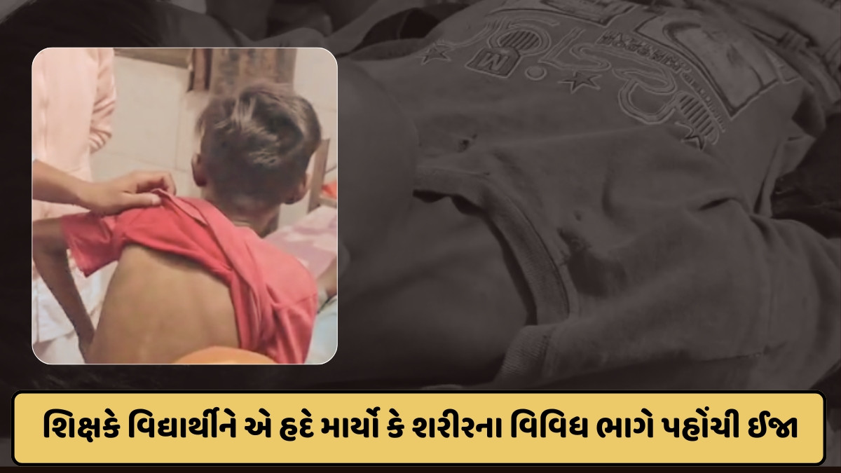 Chhota Udaipur news: શિક્ષકે સામાન્ય બાબતમાં ધોરણ-4ના વિદ્યાર્થીને માર્યો ઢોર માર, પરિવાર અને વાલીઓમાં ઉગ્ર રોષ