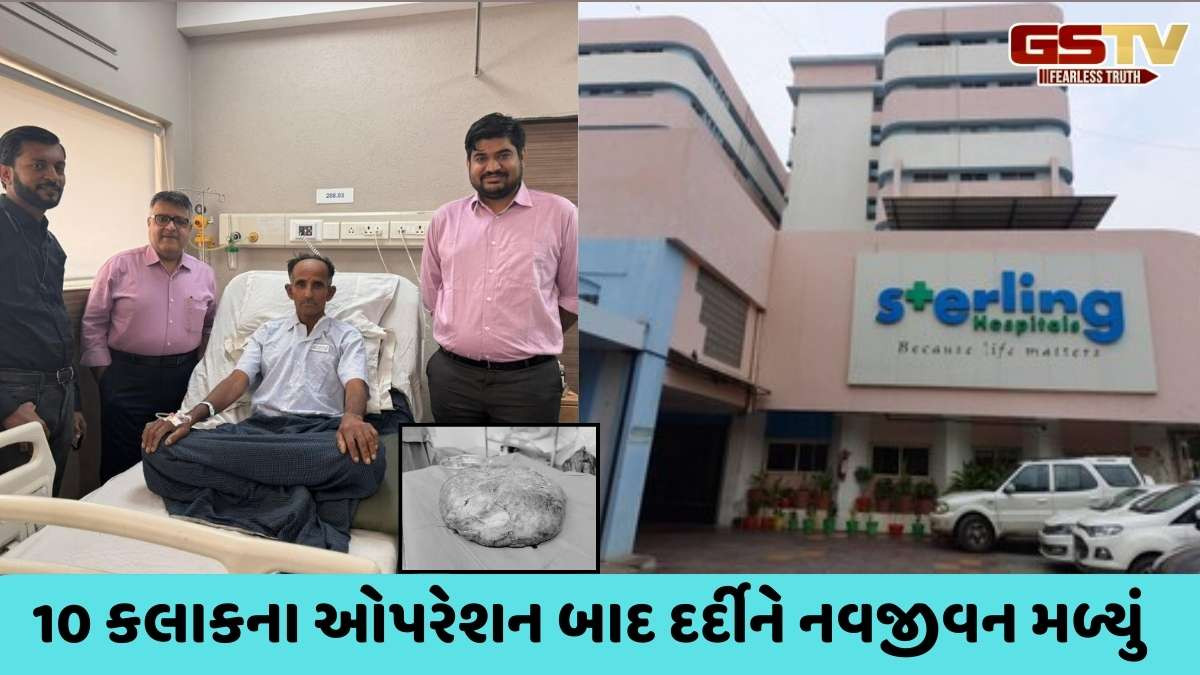 Ahmedabad news: સ્ટર્લિંગ હોસ્પિટલ્સમાં દર્દીના લીવરમાંથી સૌથી જટિલ સર્જરી કરી 3.1 કિલોની ગાંઠ કાઢવામાં આવી