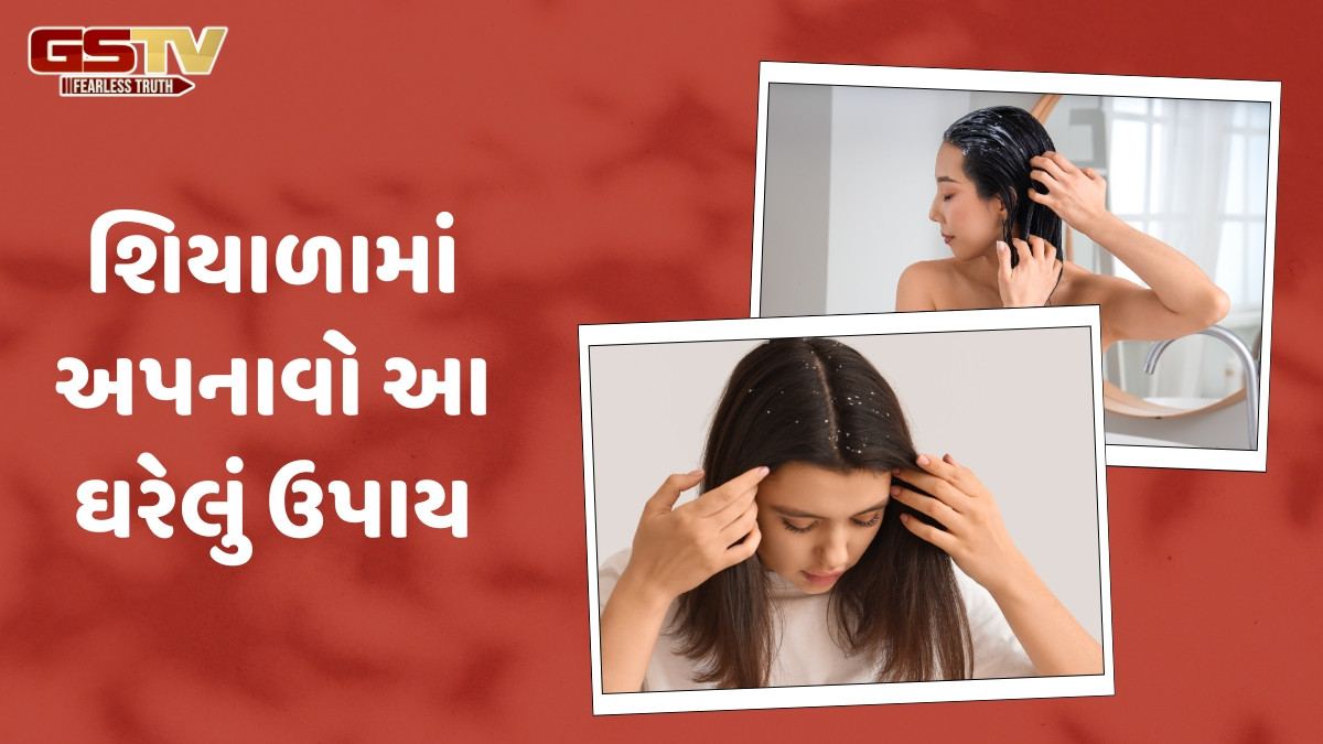 Hair Care Tips / મોંઘા પ્રોડક્ટ્સના ઉપયોગ વિના દૂર થશે ડેન્ડ્રફ, આ ઘરેલું ઉપાયથી મળશે રાહત