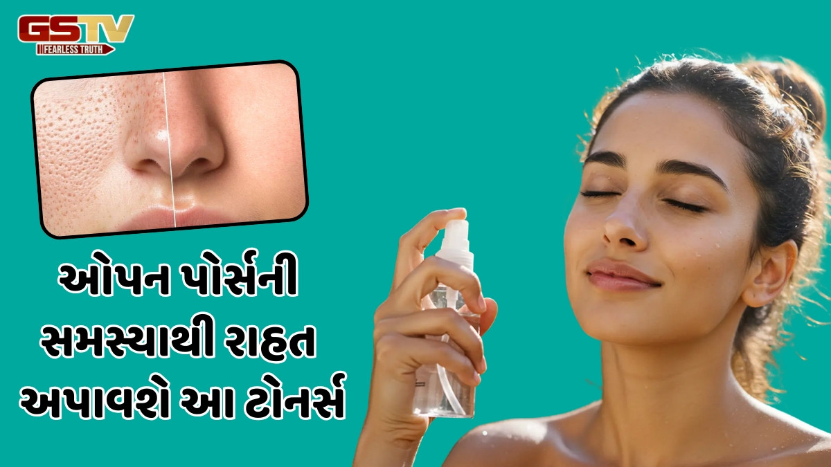 Beauty Tips / ઓપન પોર્સે છીનવી લીધી છે ચહેરાની સુંદરતા? તો અજમાવો આ 5 નેચરલ ટોનર